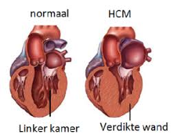 HCM HCM